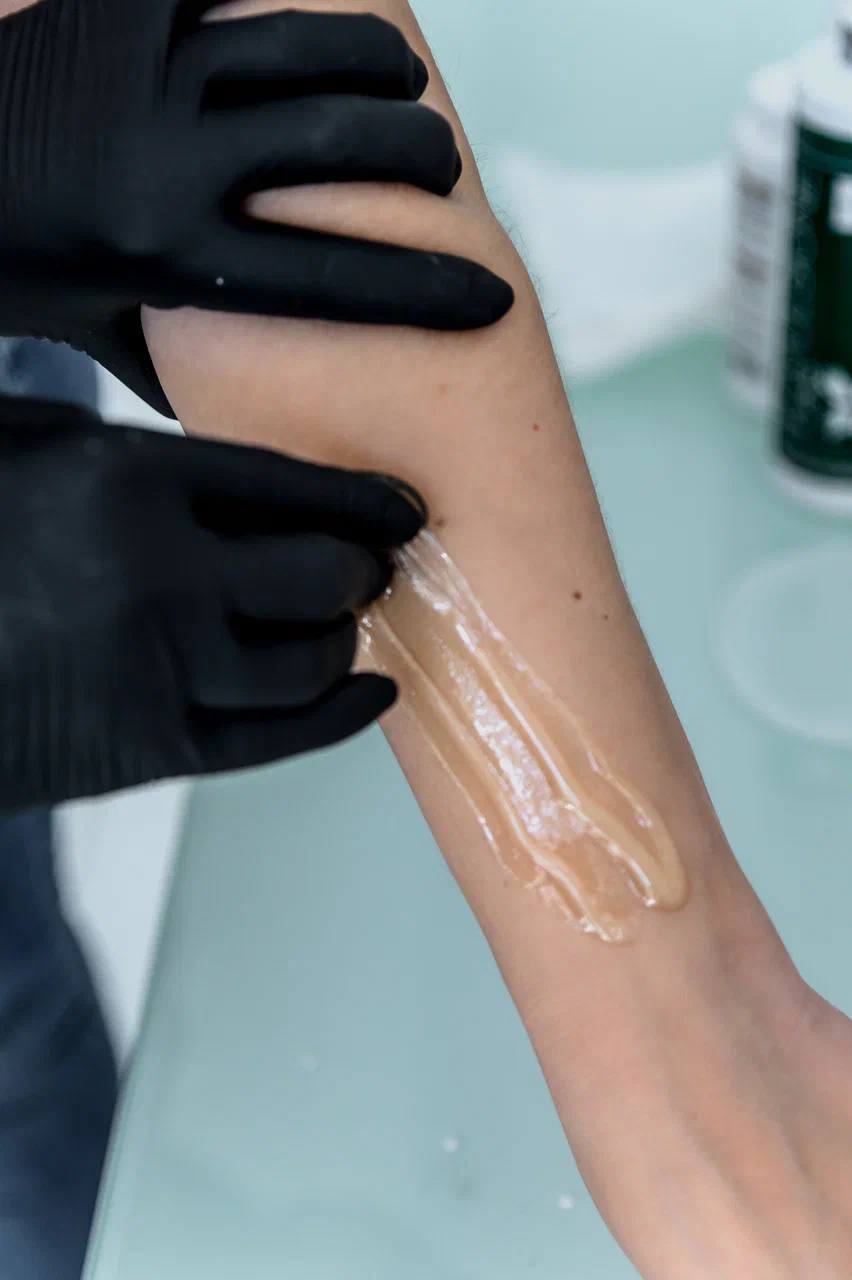 Sugaring hair removal at Beauty by Anna Holod, Limassol